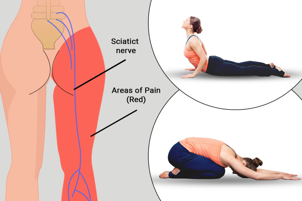 Sciatica pain relief workout - Free Yoga Workout by Aassem O. - Skimble