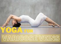 yoga for varicose veins